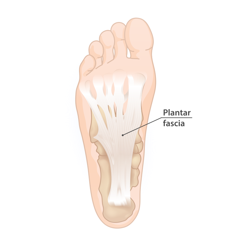 https://upload.wikimedia.org/wikipedia/commons/thumb/8/8c/Plantar_fascia.svg/langfr-800px-Plantar_fascia.svg.png